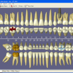 Practice Web Releases New Advanced Version 4 3 9 Of Practice Web Dental