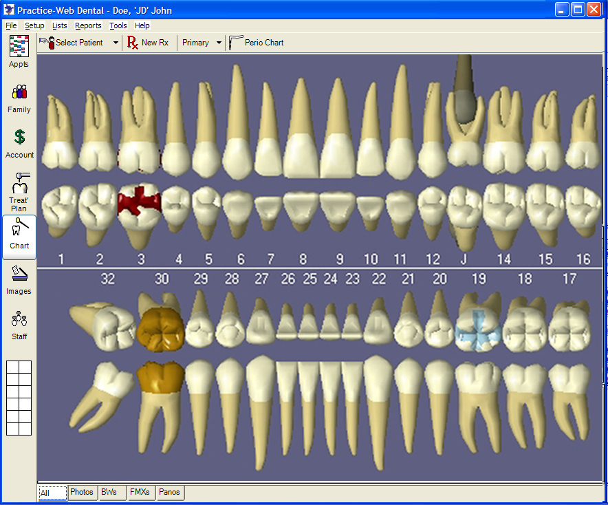 Practice Web Releases New Advanced Version 4 3 9 Of Practice Web Dental 