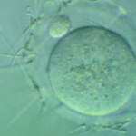 Sperm Cells Surrounding An Egg Stock Video Clip K004 6913 Science