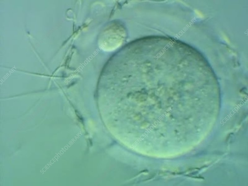 Sperm Cells Surrounding An Egg Stock Video Clip K004 6913 Science